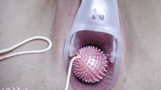 能清晰的看到子宫